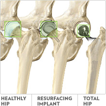 Head Size comparison